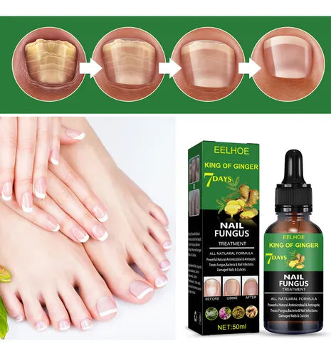 Unghie Perfette™ - Unghie belle e sane in 7 giorni